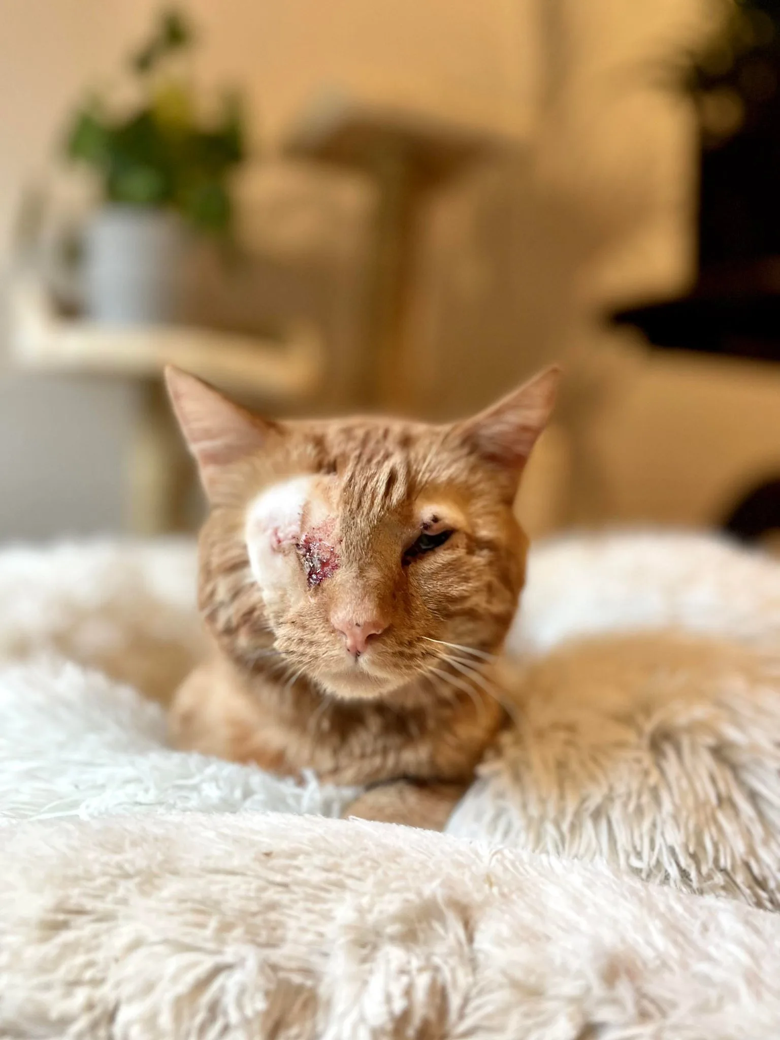 Gerry after his eye surgery